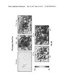 REFLECTIVE MODE MULTI-SPECTRAL TIME-RESOLVED OPTICAL IMAGING METHODS AND     APPARATUSES FOR TISSUE CLASSIFICATION diagram and image