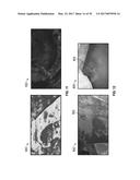 REFLECTIVE MODE MULTI-SPECTRAL TIME-RESOLVED OPTICAL IMAGING METHODS AND     APPARATUSES FOR TISSUE CLASSIFICATION diagram and image