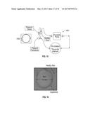 REFLECTIVE MODE MULTI-SPECTRAL TIME-RESOLVED OPTICAL IMAGING METHODS AND     APPARATUSES FOR TISSUE CLASSIFICATION diagram and image