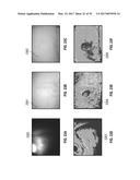 REFLECTIVE MODE MULTI-SPECTRAL TIME-RESOLVED OPTICAL IMAGING METHODS AND     APPARATUSES FOR TISSUE CLASSIFICATION diagram and image