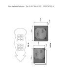 REFLECTIVE MODE MULTI-SPECTRAL TIME-RESOLVED OPTICAL IMAGING METHODS AND     APPARATUSES FOR TISSUE CLASSIFICATION diagram and image