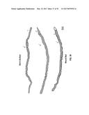 REFLECTIVE MODE MULTI-SPECTRAL TIME-RESOLVED OPTICAL IMAGING METHODS AND     APPARATUSES FOR TISSUE CLASSIFICATION diagram and image