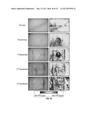 REFLECTIVE MODE MULTI-SPECTRAL TIME-RESOLVED OPTICAL IMAGING METHODS AND     APPARATUSES FOR TISSUE CLASSIFICATION diagram and image