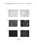 REFLECTIVE MODE MULTI-SPECTRAL TIME-RESOLVED OPTICAL IMAGING METHODS AND     APPARATUSES FOR TISSUE CLASSIFICATION diagram and image