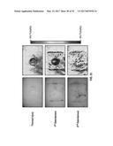 REFLECTIVE MODE MULTI-SPECTRAL TIME-RESOLVED OPTICAL IMAGING METHODS AND     APPARATUSES FOR TISSUE CLASSIFICATION diagram and image