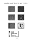 REFLECTIVE MODE MULTI-SPECTRAL TIME-RESOLVED OPTICAL IMAGING METHODS AND     APPARATUSES FOR TISSUE CLASSIFICATION diagram and image