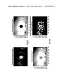 REFLECTIVE MODE MULTI-SPECTRAL TIME-RESOLVED OPTICAL IMAGING METHODS AND     APPARATUSES FOR TISSUE CLASSIFICATION diagram and image