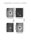 REFLECTIVE MODE MULTI-SPECTRAL TIME-RESOLVED OPTICAL IMAGING METHODS AND     APPARATUSES FOR TISSUE CLASSIFICATION diagram and image