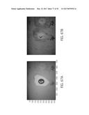 REFLECTIVE MODE MULTI-SPECTRAL TIME-RESOLVED OPTICAL IMAGING METHODS AND     APPARATUSES FOR TISSUE CLASSIFICATION diagram and image