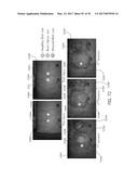 REFLECTIVE MODE MULTI-SPECTRAL TIME-RESOLVED OPTICAL IMAGING METHODS AND     APPARATUSES FOR TISSUE CLASSIFICATION diagram and image