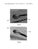 CARDIAC CATHETER EMPLOYING CONFORMAL ELECTRONICS FOR MAPPING diagram and image