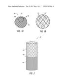 OCCLUSIVE DEVICES diagram and image