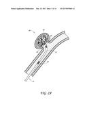 DETACHABLE TIP MICROCATHETER diagram and image