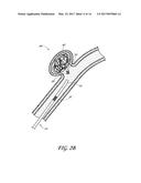 DETACHABLE TIP MICROCATHETER diagram and image