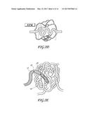 DETACHABLE TIP MICROCATHETER diagram and image