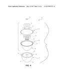 TISSUE EXPANDERS AND METHODS OF USE diagram and image