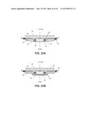 TISSUE EXPANDERS AND METHODS OF USE diagram and image