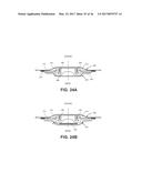 TISSUE EXPANDERS AND METHODS OF USE diagram and image