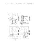 TISSUE EXPANDERS AND METHODS OF USE diagram and image