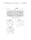 METHOD FOR STENT SHAPING diagram and image