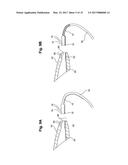 HEARING AID DEVICE WITH INTEGRATED ANTENNA diagram and image