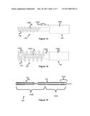 Guidewire With Torque Transmission Element diagram and image