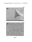 TISSUE ENGINEERING DEVICE AND CONSTRUCTION OF VASCULARIZED DERMIS diagram and image