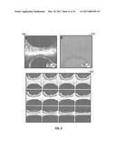 TISSUE ENGINEERING DEVICE AND CONSTRUCTION OF VASCULARIZED DERMIS diagram and image