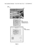 TISSUE ENGINEERING DEVICE AND CONSTRUCTION OF VASCULARIZED DERMIS diagram and image