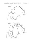 AIRBAG diagram and image