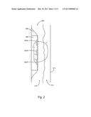 IMPEDANCE ANALYSIS FOR FLUID DISCRIMINATION AND MONITORING diagram and image