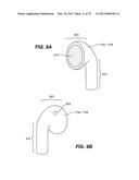 EARBUDS WITH ACOUSTIC INSERT diagram and image