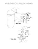 EARBUDS WITH ACOUSTIC INSERT diagram and image