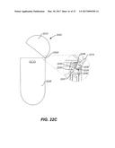 EARBUDS WITH ACOUSTIC INSERT diagram and image