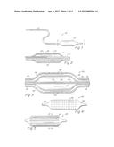 BALLOON CATHETER HAVING METAL BALLOON AND METHOD OF MAKING SAME diagram and image