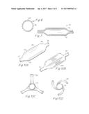 BALLOON CATHETER HAVING METAL BALLOON AND METHOD OF MAKING SAME diagram and image