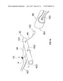 Assembly for Securing Gastrointestinal Tissue Folds diagram and image