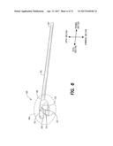 Vein Dissecting Device and Method diagram and image