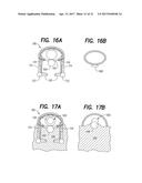 Vein Dissecting Device and Method diagram and image