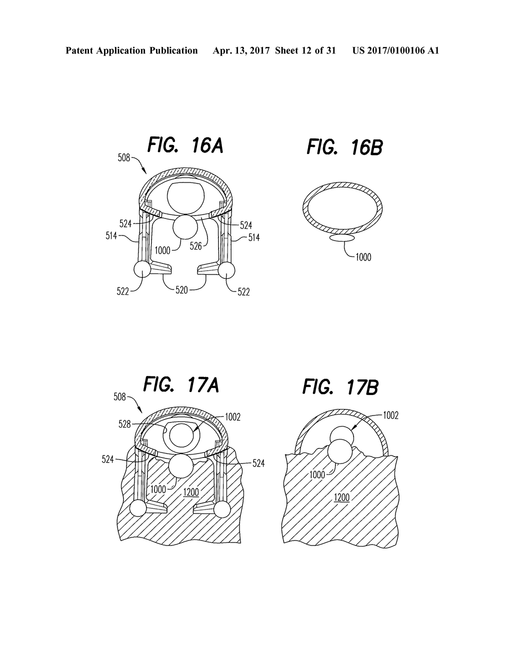 Vein Dissecting Device and Method - diagram, schematic, and image 13