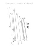 Vein Dissecting Device and Method diagram and image