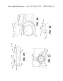 Vein Dissecting Device and Method diagram and image