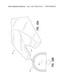 Vein Dissecting Device and Method diagram and image