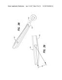 Vein Dissecting Device and Method diagram and image