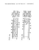 VEIN DISSECTING DEVICE AND METHOD diagram and image