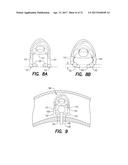 VEIN DISSECTING DEVICE AND METHOD diagram and image