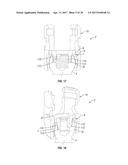 ORTHOPEDIC FIXATION DEVICES AND METHODS OF INSTALLATION THEREOF diagram and image