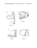 Interspinous Process Spacing Device diagram and image