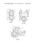 Interspinous Process Spacing Device diagram and image