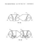 Interspinous Process Spacing Device diagram and image